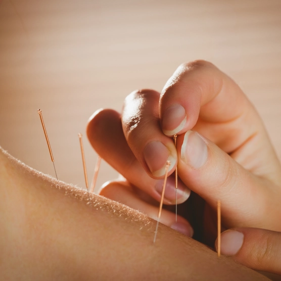 home-acupuncture-img