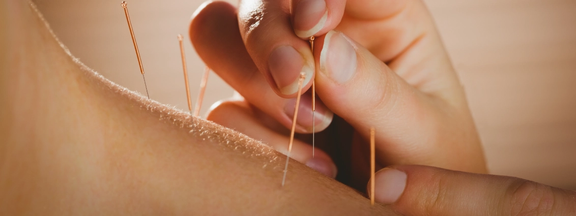 services-acupuncture-img