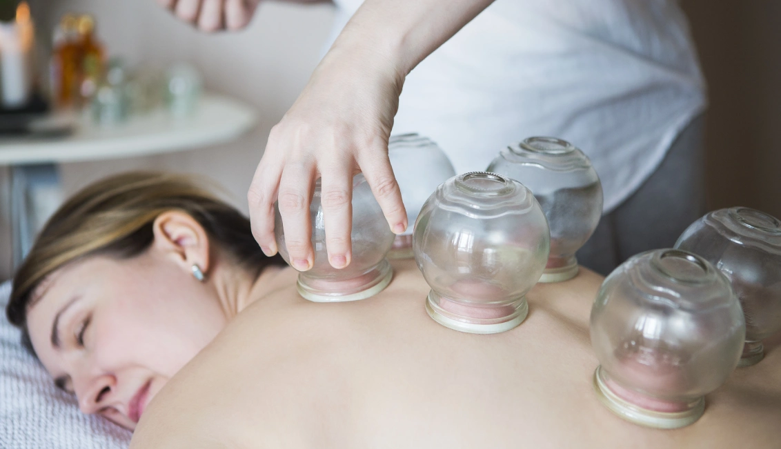 services-cupping-therapy-img
